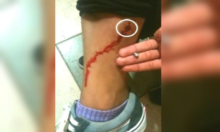 Una joven fue herida por un "francotirador" en Villa Rosa
