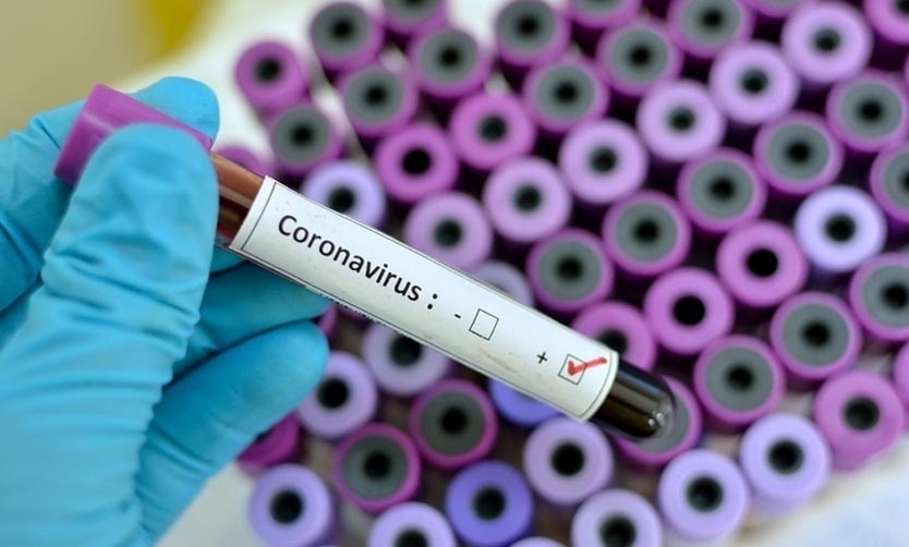 En las últimas 24 horas se diagnosticaron 2285 nuevos casos de COVID en el país