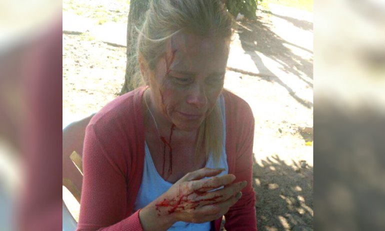 Salvaje ataque a una mujer para robarle: la cortaron con un vidrio y la apedrearon