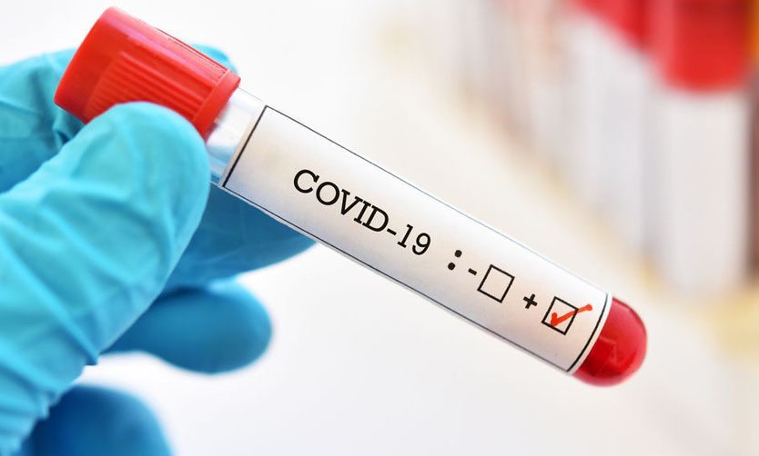 Se diagnosticaron 3 nuevos casos de COVID-19 en Pilar y el total asciende a 79