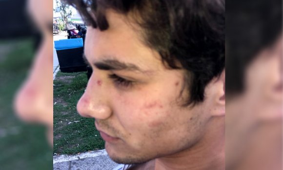 Habló el joven golpeado por un policía: "Pensé que me mataban"